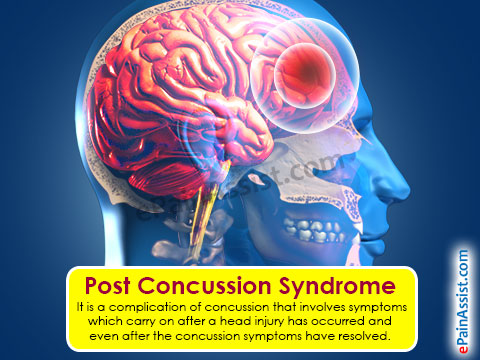 post-concussion-syndrome